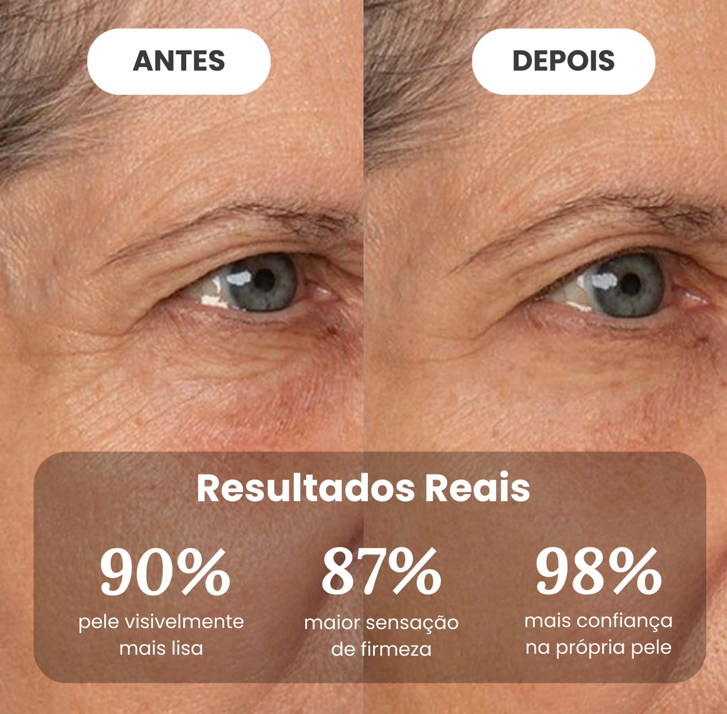 Creme antirrugas Veneno de Abelha