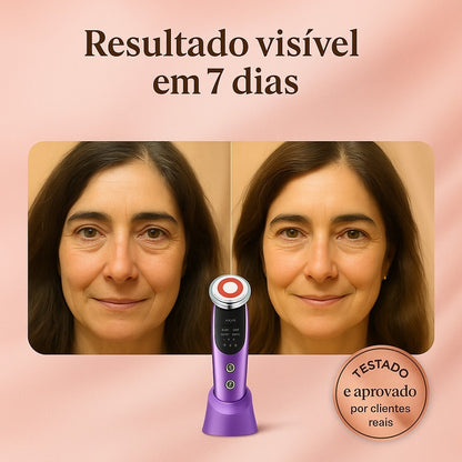 LumaLift™ - Lifting e Anti-Envelhecimento